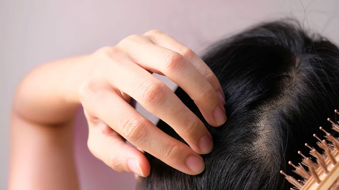 ¿Puedo tener alopecia por ansiedad debido al coronavirus?