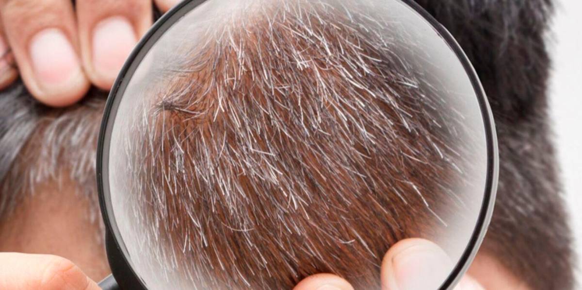 ¿Sabías que el pelo también sufre envejecimiento?