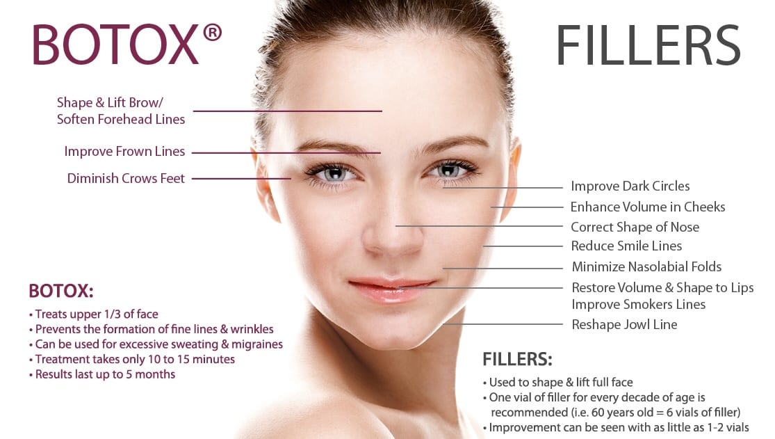 Tratamientos de botox y fillers: ¿vale la pena y cuáles son los precios en Lima?